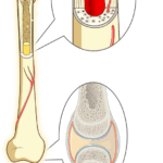 שיעור 105 התב”מ בעצמות ומפרקי השלד והתפתחות של לוקמיה (מוקלט, כפול)