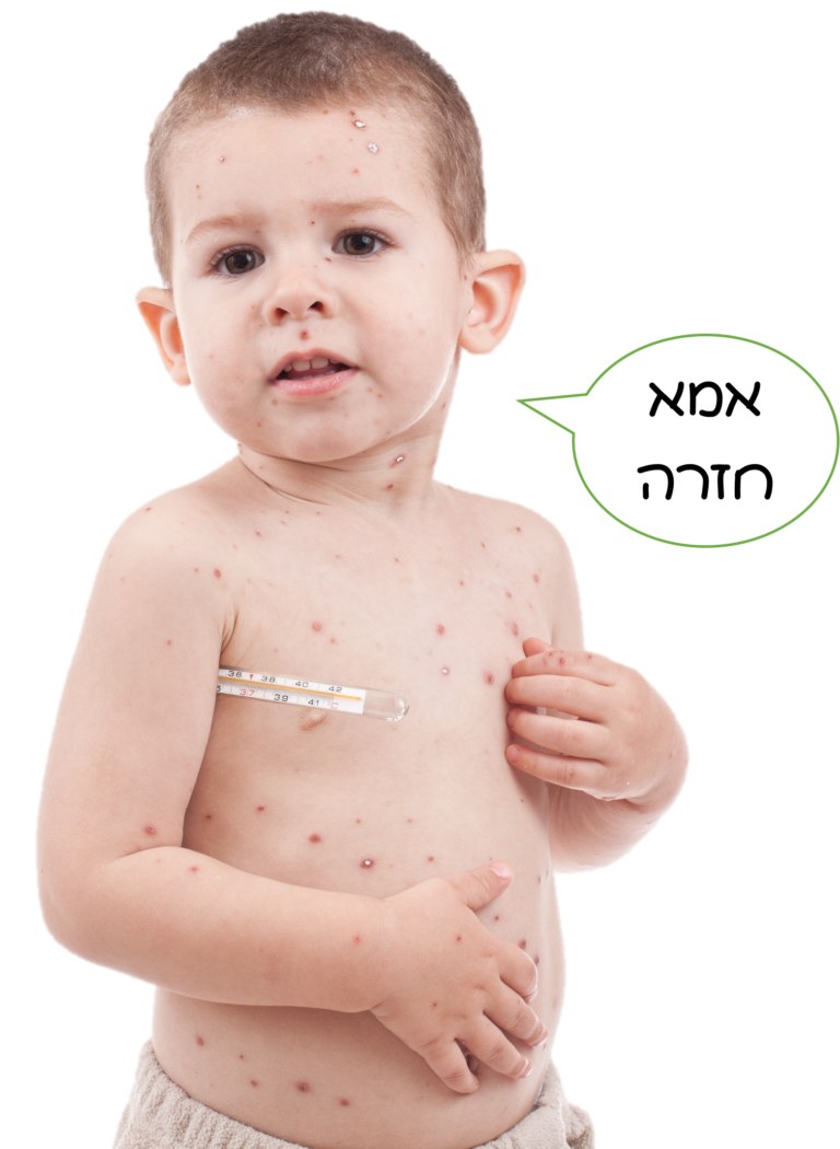 rash-smallpox-boy-kid-baby-talk-Depositphotos_5894591_xl-2015